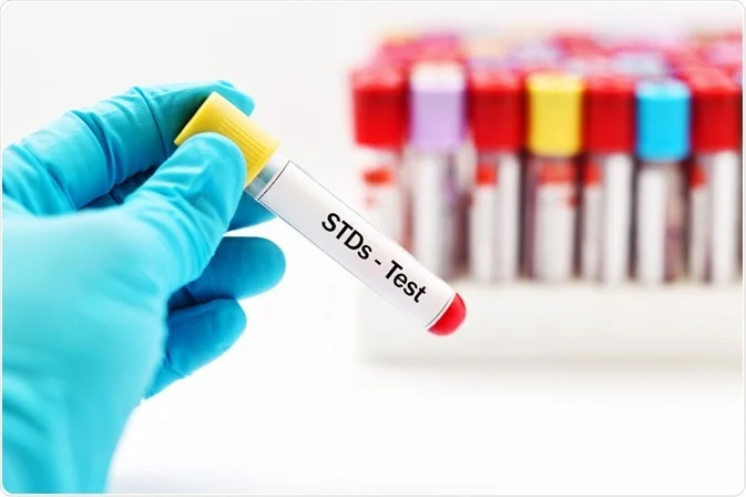 STD testing in Dubai