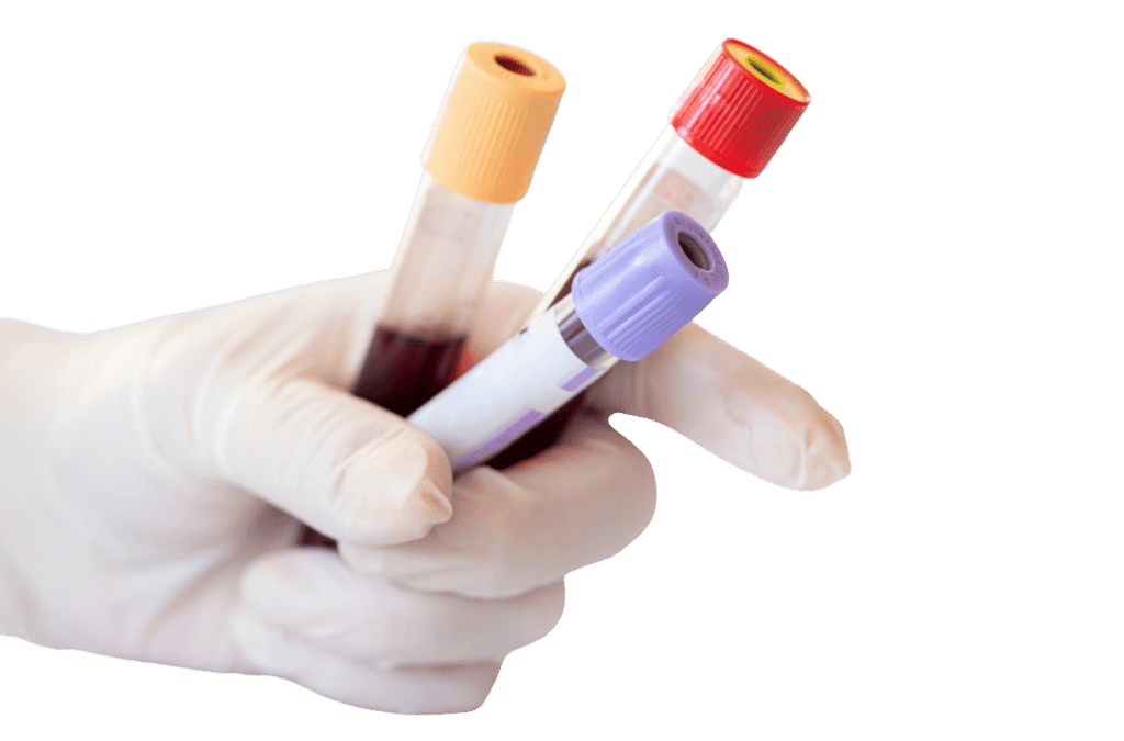 understanding-the-different-types-of-blood-tests-a-comprehensive-guide