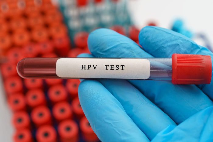 Understanding the Different Types of STD Tests Available in Dubai
