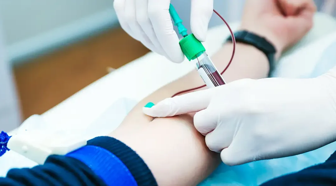 How to Prepare for Your Blood Test: Tips and Advice