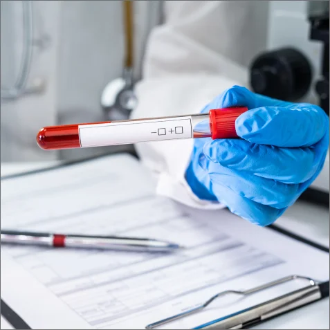 When do STD symptoms start?