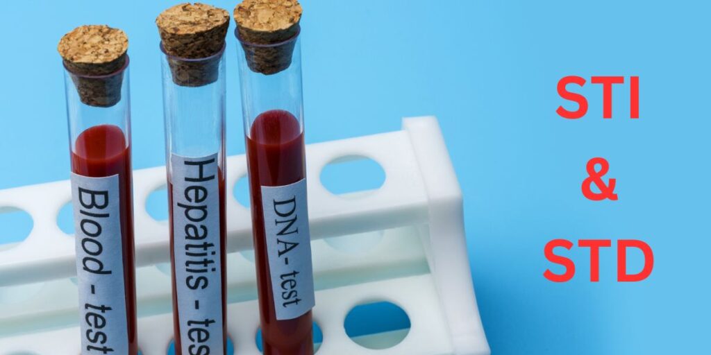 How do I check if I have STD?