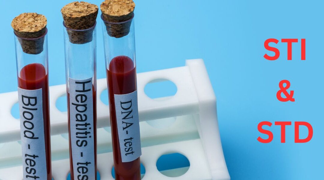 How do I check if I have STD?